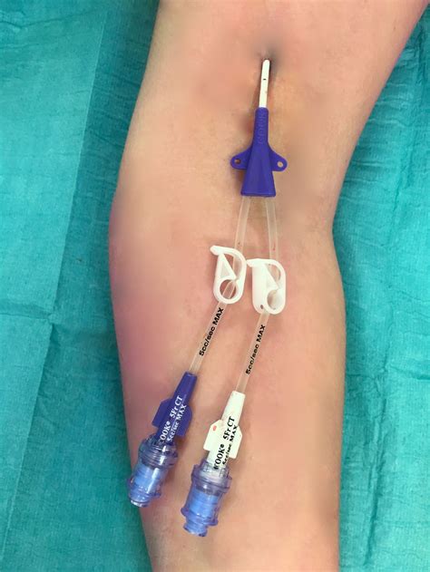 How To Draw Blood In Picc Line