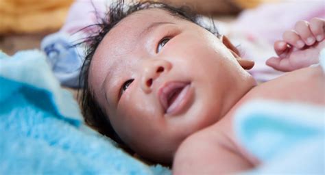 What to do if your baby has a swollen eye | BabyCenter