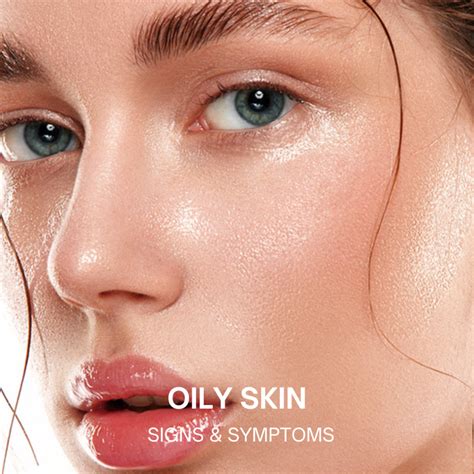 Understanding Oily Skin: Causes, Management, and Solutions
