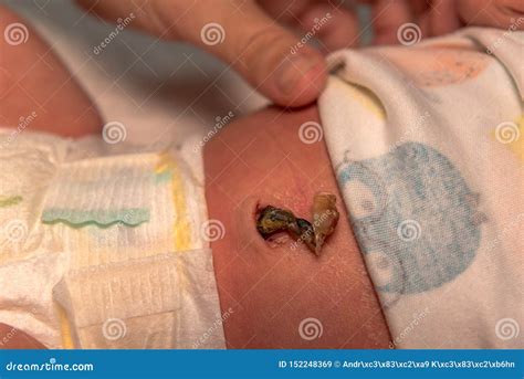 A Young Mother Examines the Umbilical Cord Stock Image - Image of hand ...