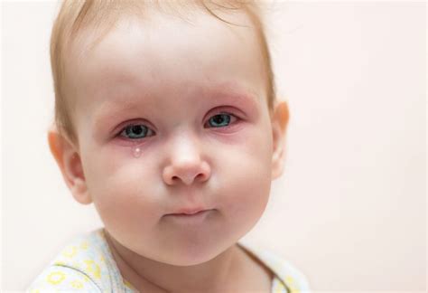 Newborn Eye Discharge: Causes, Symptoms, & Effective Treatments
