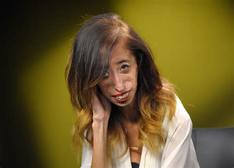 Lizzie Velasquez, once dubbed ‘world’s ugliest woman,’ shares how she ...