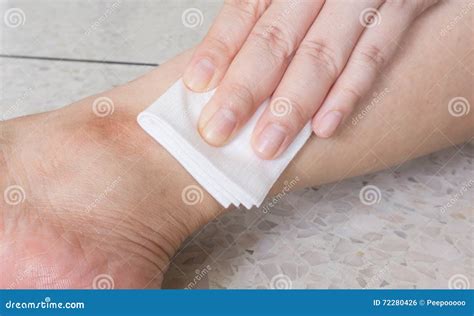 What Happens If You Leave Gauze Stuck To A Wound at Curtis Deborah blog