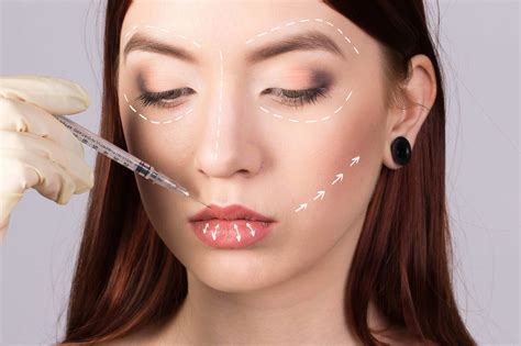 Does Lip Filler Migrate? | Dermaq Aesthetics