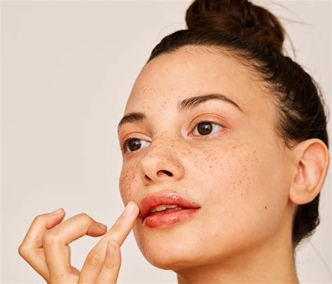 How To Get Rid Of Dry Skin Inside Mouth at Nicholas Mckillop blog