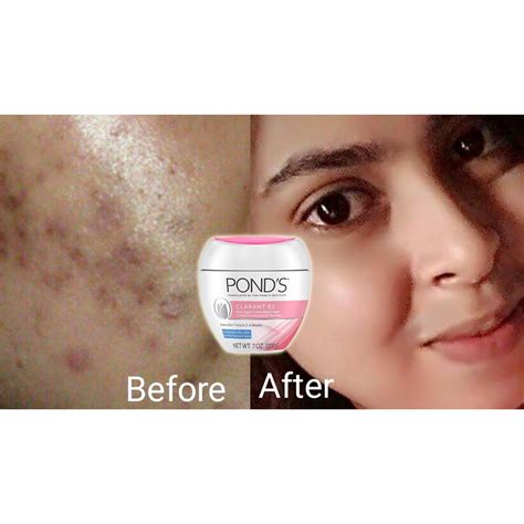 (Us Standard) Pond'S Clarant B3 Dark Spot Correcting Cream (200g ...