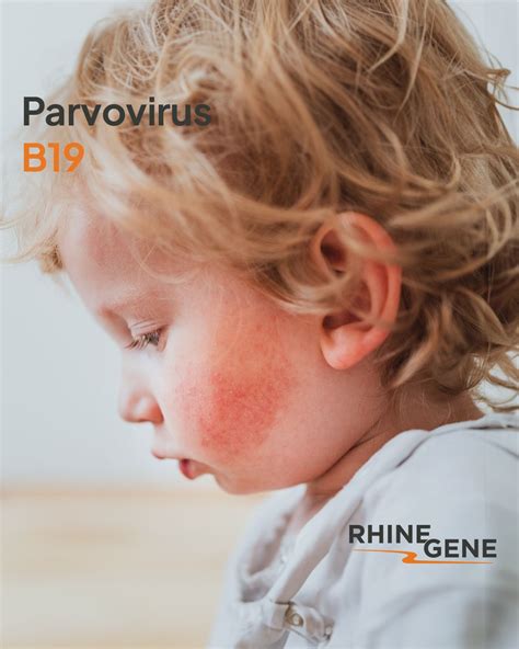 Parvovirus B19 is a contagious virus that primarily affects humans. It is responsible for a ...
