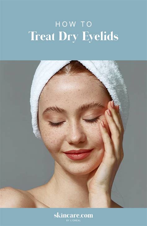 What Do You Use For Dry Eyelids at David Beach blog