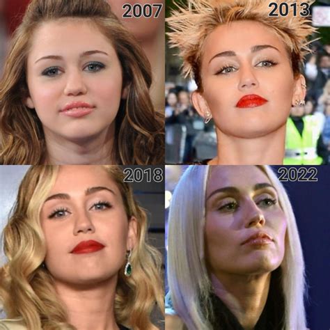 Miley Cyrus Plastic Surgery: A Comprehensive Look