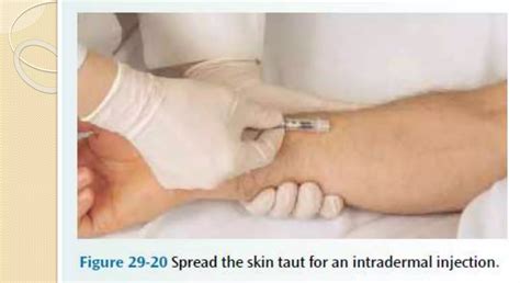 Administering an intradermal injection.pptx
