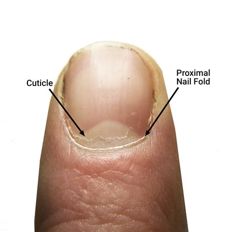 The Cuticle – Should You Clip, Push, or Scrape? | Nagelriemen verzorgen ...