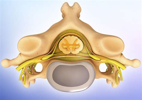 What a Nucleus Pulposus Is and How Herniation Happens