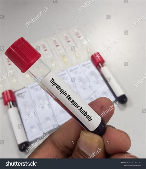 Blood Sample Thyrotropin Receptor Antibody Test Stock Photo 2207302181 ...