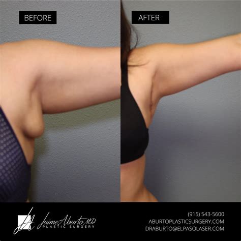 Transform and Thrive! This before-and-after highlights the results of a ...