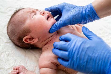 Baby having developed neck rash and skin irritation | Premium Photo