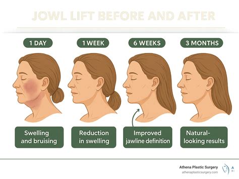 Jowl lift before after: 9 Jaw-Dropping Results in 2025