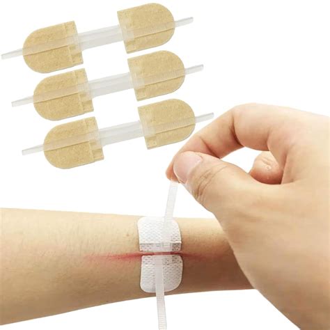 Stitch Tape For Wounds at Vaughn Josephs blog