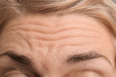 Fade Forehead Wrinkles: Top Ingredients & Tips