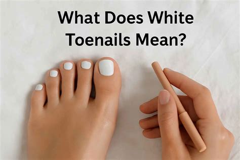 What Does White Toenails Mean? Causes & Warning Signs | Credihealth