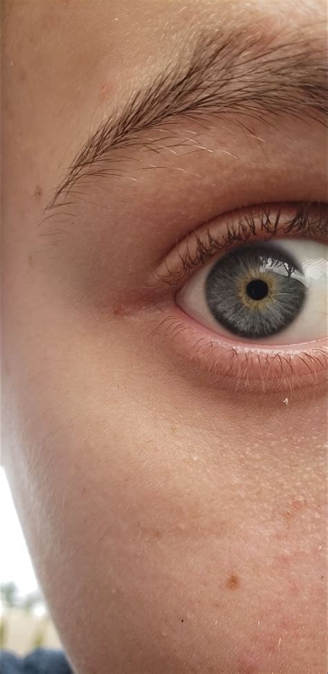 I just learned I have a type of heterochromia : r/pics
