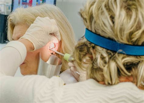 Earwax Removal Near Me