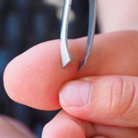 How To Get A Sliver From Under Your Fingernail at Jose Credle blog - splinter under fingernail