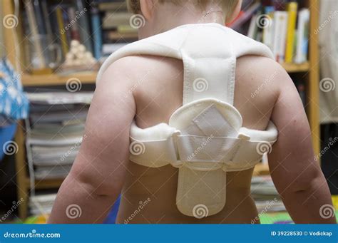 Fixation of Fractured Bone in Toddler Stock Photo - Image of pain ...