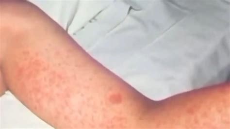 Reality behind not masturbating as 'health benefits' explained after doctor shared how often it ...