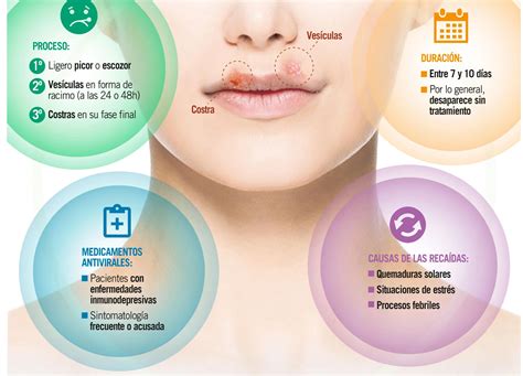 Herpes Labial Por Estrés: Causas, Síntomas Y Tratamiento | Doctor Online