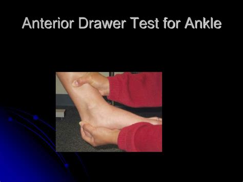 PPT - Bowlegs or genu varum PowerPoint Presentation, free download - ID ...