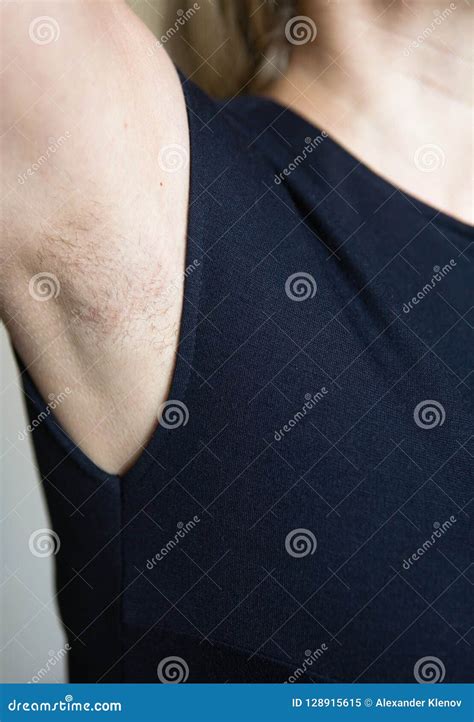 Armpit Hair White Coating at Andrew Gillan blog