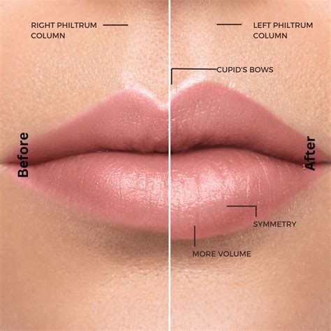 Lip Shapes: Understanding and Enhancing Your Natural Beauty