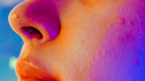 White Dots Under Eyes Not Milia / Eyelid Bumps 101 How To Identify Styes Milia Pimples Allure ...