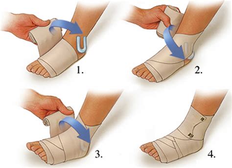 How To Wrap Ace Bandage For Sprained Ankle at Darren Pennington blog