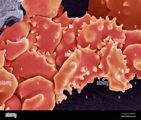 Crenated red blood cells hi-res stock photography and images - Alamy