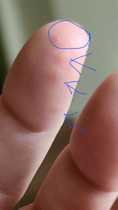 Finger Tip Numb Stroke at Alex Cruz blog