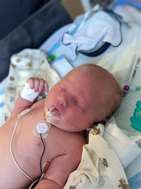Baby Born At 37 Weeks