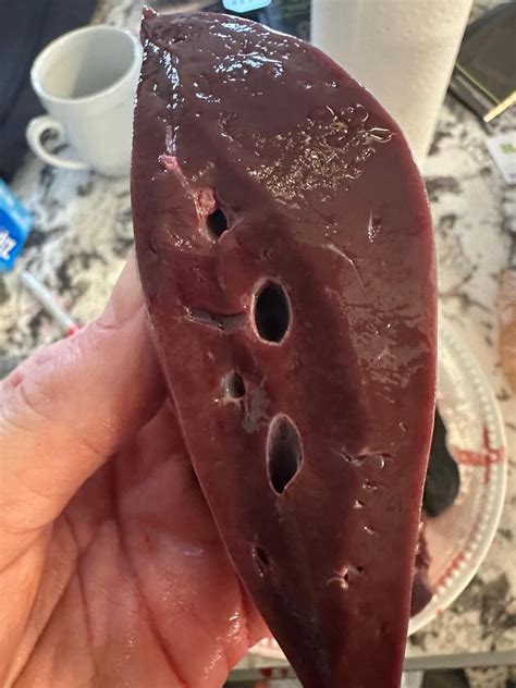 What Kills Liver Flukes