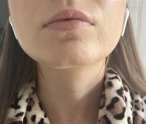 What are these bumps, I don’t think it’s acne. How do I improve my skin texture? It’s most ...