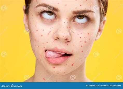 Woman with Red Dots on Her Face Skin Problems Dermatology Dissatisfaction Stock Image - Image of ...