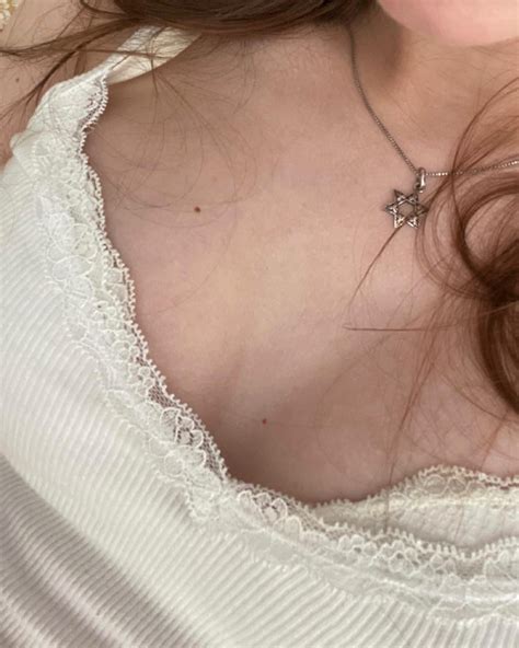 Blind pimples (no head) after 2 weeks? Did they turn into scars? : r/acne