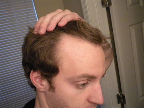 8 Tips to Receding Hairline Haircut Men'S Health - Life More cuy