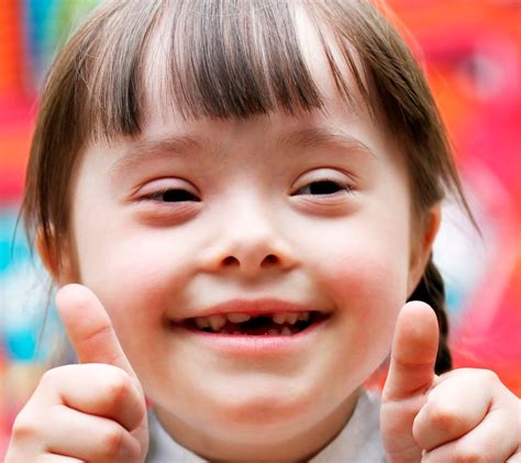 11 Facts About Down Syndrome