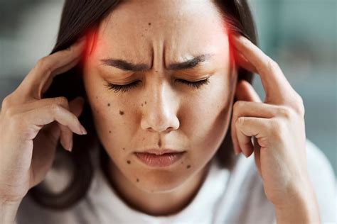 50 Facts About New Daily Persistent Headache - Facts.net