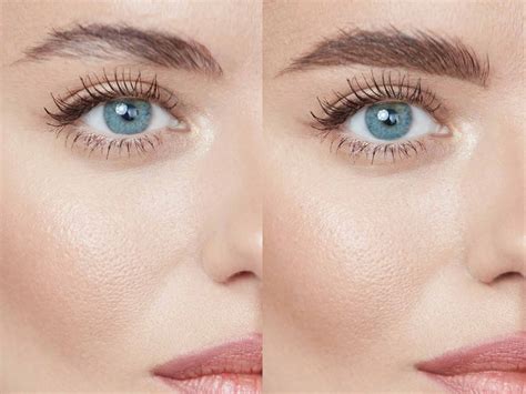 Tattooing Of Eyebrows Can Cause Infections, Keloid, Dermatologist Says