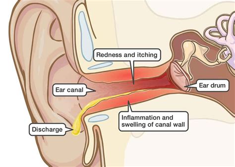 Itchy inside ear, itchy painful ear causes & treatment