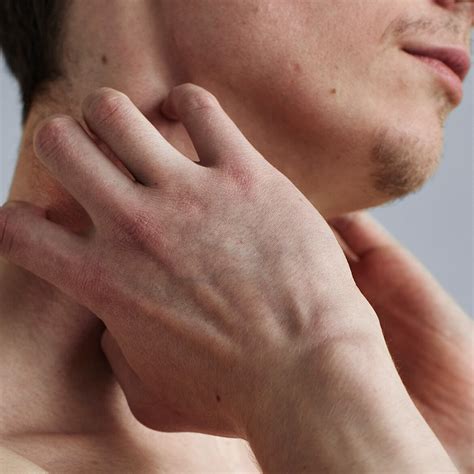 What Causes Eczema Flare-Ups? | Cetaphil US