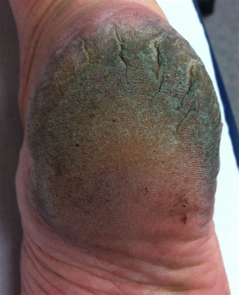 Health Symptoms : Causes, Treatment, Conditions and More