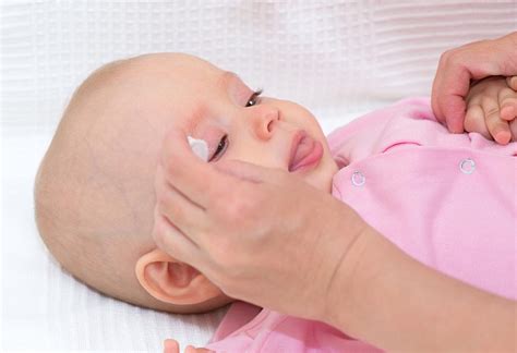 Eye Discharge in Newborn Babies: Causes and Treatment