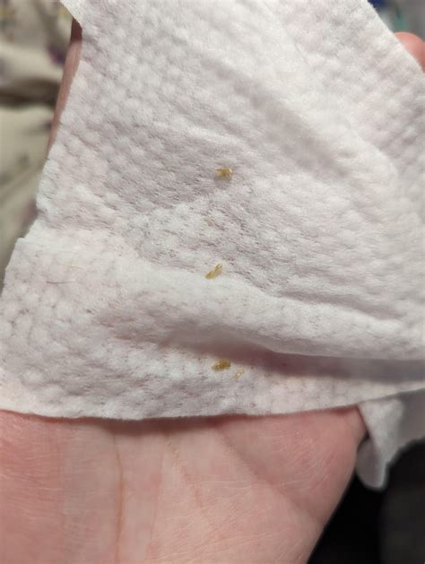 Baby eye crusty : r/firsttimemom
